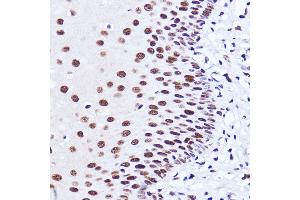 Immunohistochemistry (IHC) image for anti-Matrin 3 (MATR3) (AA 747-847) antibody (ABIN7268415)