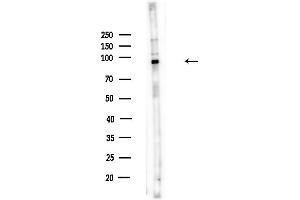 Western blot analysis of lysates from HUVEC cells(UV,30 min treatment), using DPP9 - Catalytic domain Antibody at 1/1000 dilution.