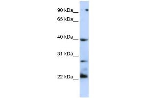 WB Suggested Anti-TNFRSF10B Antibody Titration:  0. (TNFRSF10B antibody  (N-Term))