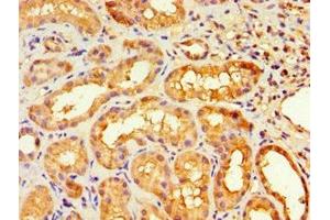 Immunohistochemistry of paraffin-embedded human kidney tissue using ABIN7155729 at dilution of 1:100 (HOXA9 antibody  (AA 1-190))