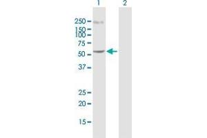 Western Blot analysis of C14orf21 expression in transfected 293T cell line by C14orf21 MaxPab polyclonal antibody. (C14orf21 antibody  (AA 1-536))