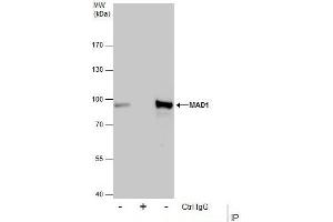 IP Image Immunoprecipitation of MAD1 protein from HeLa whole cell extracts using 5 μg of MAD1 antibody, Western blot analysis was performed using MAD1 antibody, EasyBlot anti-Rabbit IgG  was used as a secondary reagent. (PSMD14 antibody  (Center))