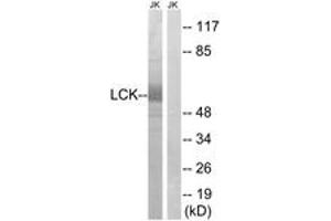Western blot analysis of extracts from Jurkat cells, using LCK (Ab-59) Antibody.