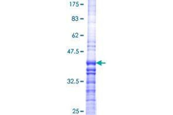 Bestrophin 3 Protein (BEST3) (AA 169-267) (GST tag)