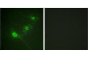 Immunofluorescence analysis of NIH-3T3 cells, using LKB1 (Phospho-Ser428) Antibody. (LKB1 antibody  (pSer428))