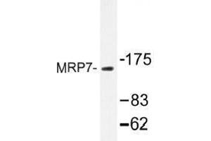 Image no. 1 for anti-ATP-Binding Cassette, Sub-Family C (CFTR/MRP), Member 10 (ABCC10) antibody (ABIN317845) (ABCC10 antibody)