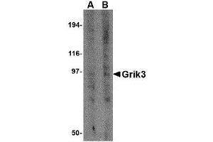 Image no. 1 for anti-Glutamate Receptor, Ionotropic, Kainate 3 (GRIK3) (N-Term) antibody (ABIN1494385) (GRIK3 antibody  (N-Term))