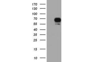 Western Blotting (WB) image for anti-Ribosomal Protein S6 Kinase, 70kDa, Polypeptide 1 (RPS6KB1) antibody (ABIN1500001)