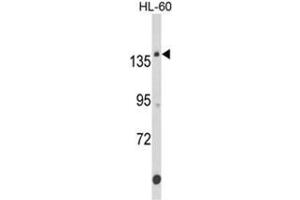 Western blot analysis of FNDC3B Antibody (N-term) in HL-60 cell line lysates (35ug/lane).