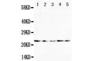 Anti-FGF10 antibody, Western blotting Lane 1: U87 Cell Lysate Lane 2: HELA Cell Lysate Lane 3: A519 Cell Lysate Lane 4: 293T Cell Lysate Lane 5: HELA Cell Lysate (FGF10 antibody  (N-Term))