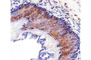 Immunohistochemical analysis of paraffin-embedded mouse esophagus using EGF Receptor antibody at 1:25 dilution. (EGFR antibody  (AA 1163-1191))