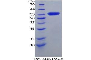 SDS-PAGE analysis of Mouse LRP1 Protein. (LRP1 Protein)