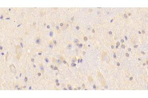 Detection of CARNS1 in Mouse Cerebrum Tissue using Polyclonal Antibody to Carnosine Synthase 1 (CARNS1) (CARNS1 antibody  (AA 623-826))