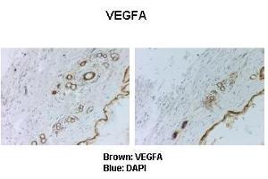 Sample Type: LNCap cells  Primary Antibody Dilution: 1:500Secondary Antibody: Anti-rabbit-HRP  Secondary Antibody Dilution: 1:0000Color/Signal Descriptions: Brown: VEGFA Blue: DAPI   Gene Name: VEGFA Submitted by: Christina Theodorpoulos, Queensland Univ. (VEGFA antibody  (C-Term))