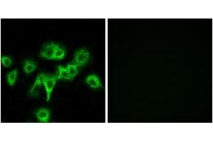 Immunofluorescence analysis of HeLa cells, using CDON Antibody. (CDON antibody  (AA 511-560))