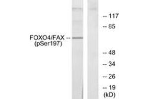 Western blot analysis of extracts from 293 cells treated with serum, using AFX (Phospho-Ser197) Antibody. (FOXO4 antibody  (pSer197))