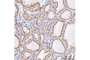 IHC analysis of RING2/RING1B/RNF2 using anti-RING2/RING1B/RNF2 antibody (ABIN7599286). (RNF2 antibody  (AA 1-336))