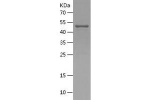 Western Blotting (WB) image for Lysosomal-Associated Membrane Protein 3 (LAMP3) (AA 30-280) protein (His-IF2DI Tag) (ABIN7123814) (LAMP3 Protein (AA 30-280) (His-IF2DI Tag))