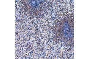 IHC analysis of SETD3 using anti-SETD3 antibody (ABIN7600293). (SETD3 antibody  (AA 173-468))