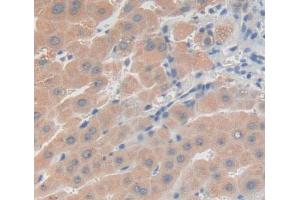 Used in DAB staining on fromalin fixed paraffin- embedded Kidney tissue (PRKD3 antibody  (AA 576-832))