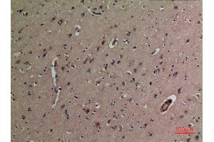 Immunohistochemistry (IHC) image for anti-Tumor Necrosis Factor Receptor Superfamily, Member 25 (TNFRSF25) (Internal Region) antibody (ABIN6282415)