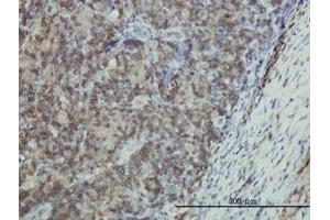 Image no. 1 for anti-Epithelial Membrane Protein 3 (EMP3) (AA 1-164) antibody (ABIN598660) (EMP3 antibody  (AA 1-164))