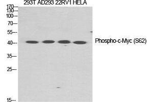 Western Blot (WB) analysis of specific cells using Phospho-c-Myc (S62) Polyclonal Antibody.