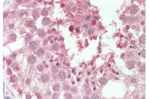 Rabbit Anti-PSMA6 antibody  Formalin Fixed Paraffin Embedded Tissue: Human Testis Primary antibody Concentration: 1:100 Secondary Antibody: Donkey anti-Rabbit-Cy3 Secondary Antibody Concentration: 1:200 Magnification: 20x Exposure Time: 0. (PSMA6 antibody  (N-Term))