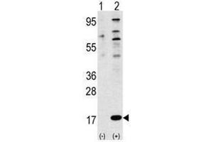 Image no. 2 for anti-Finkel-Biskis-Reilly Murine Sarcoma Virus (FBR-MuSV) Ubiquitously Expressed (FAU) (N-Term) antibody (ABIN357135) (FAU antibody  (N-Term))