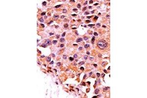 Image no. 1 for anti-Protein Phosphatase 3, Catalytic Subunit, alpha Isoform (PPP3CA) (N-Term) antibody (ABIN360808) (PPP3CA antibody  (N-Term))