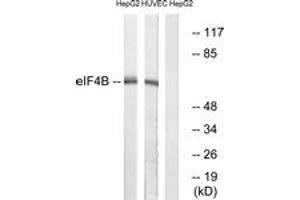 Western blot analysis of extracts from HepG2/HuvEc cells, using eIF4B (Ab-422) Antibody. (EIF4B antibody  (AA 388-437))