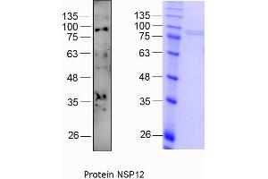 Quality Control Images: Western Blotting + SDS-PAGE (SARS-CoV-2 NSP12 (RdRP) Protein (His tag))