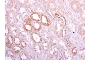 IHC-P Image Ribophorin I antibody [C2C3], C-term detects Ribophorin I protein at cytoplasm on human normal kidney by immunohistochemical analysis. (RPN1 antibody  (C-Term))