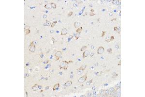 Immunohistochemistry of paraffin-embedded Mouse brain using WBSCR27 Rabbit pAb (ABIN7271366) at dilution of 1:50 (40x lens). (WBSCR27 antibody  (AA 1-245))