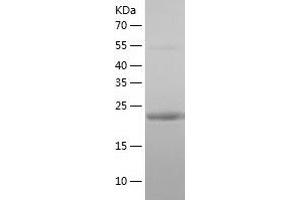 Western Blotting (WB) image for Lin-7 Homolog B (LIN7B) (AA 1-207) protein (His tag) (ABIN7288883) (LIN7B Protein (AA 1-207) (His tag))