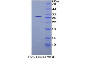 SDS-PAGE analysis of Human GSTa1 Protein. (GSTA1 Protein)