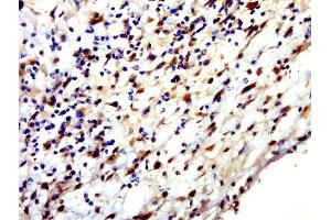 Paraformaldehyde-fixed, paraffin embedded human skin, Antigen retrieval by boiling in sodium citrate buffer (pH6. (HENMT1 antibody  (AA 1-100))