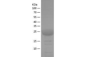 Western Blotting (WB) image for Protein Phosphatase 2 Regulatory Subunit 2A (PPP2R2A) (AA 71-107) protein (His-IF2DI Tag) (ABIN7124671) (PPP2R2A Protein (AA 71-107) (His-IF2DI Tag))
