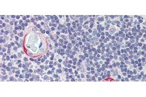 Rabbit Anti-CPXCR1 Antibody Catalog Number: arp39743 Paraffin Embedded Tissue: Human Tymus Antibody Concentration: 10 ug/ml (CPXCR1 antibody  (Middle Region))
