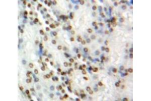 #VALUE! (BRCA1 antibody  (AA 1524-1781))