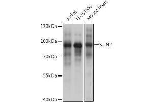 Western blot analysis of extracts of various cell lines, using SUN2 antibody (ABIN7270136) at 1:1000 dilution. (SUN2 antibody)