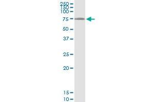 Immunoprecipitation of LARP6 transfected lysate using anti-LARP6 MaxPab rabbit polyclonal antibody and Protein A Magnetic Bead , and immunoblotted with LARP6 purified MaxPab mouse polyclonal antibody (B01P) . (LARP6 antibody  (AA 1-491))