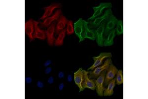ABIN6259009 and ABIN6276163 staining Hela cells by IF/ICC.