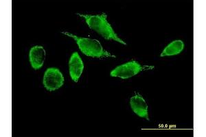 Immunofluorescence (IF) image for anti-ATPase Family, AAA Domain Containing 3A (ATAD3A) (AA 1-586) antibody (ABIN527421)