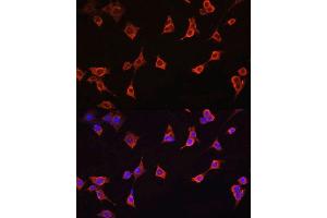 Immunofluorescence analysis of NIH/3T3 cells using CFL1 antibody. (Cofilin antibody  (AA 1-100))