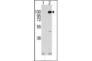 Western blot analysis of FGFR1 (arrow) using rabbit polyclonal FGFR1 Antibody. (FGFR1 antibody  (Tyr766))