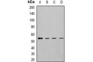 Western blot analysis of DLD expression in MCF7 (A), K562 (B), mouse kidney (C), mouse liver (D) whole cell lysates. (DLD antibody)
