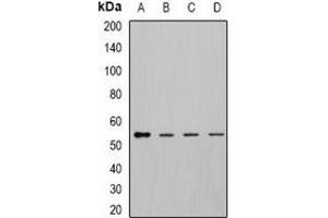 Western blot analysis of DLD expression in MCF7 (A), K562 (B), mouse kidney (C), mouse liver (D) whole cell lysates. (DLD antibody)