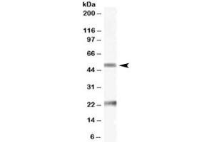 Western blot testing of human ovay lysate with Fibulin 5 antibody at 0. (Fibulin 5 antibody)