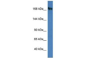 WB Suggested Anti-NUP153 Antibody Titration: 1. (NUP153 antibody  (C-Term))